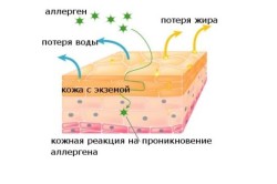 Alergia la praf de spălat simptomele de copil, tratament (foto)