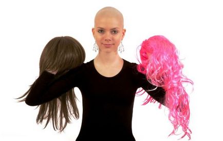 Alopecia la femei, simptome, cauze, boala poate duce la