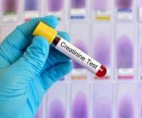Un test de sange pentru creatininei - ceea ce este