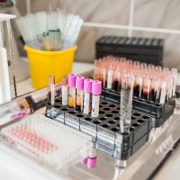 Un test de sange pentru creatininei - ceea ce este