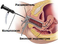 Biopsia a ceea ce este