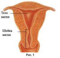Biopsia de col uterin
