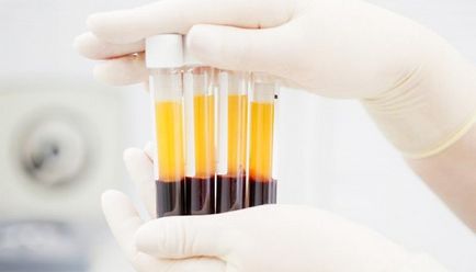 sange chimie standarde (biochimie), decodare