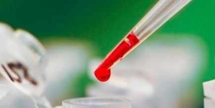 Analiza biochimică a sângelui și rata rezultatelor de decodare la adulți