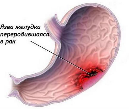 Analiza biochimică a sângelui - norma, descifrarea analiza biochimică a sângelui