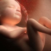 dimensiunea biparietal a capului fetale la 32 de săptămâni, 32 de săptămâni de sarcină