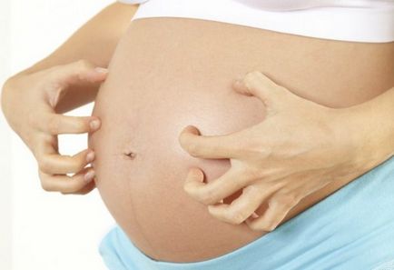 burta Râios in timpul sarcinii cauze, tratament, remedii populare