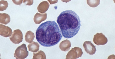 Aceasta arată analiza biochimică a sângelui dintr-o venă, pentru ceea ce este, și după cum reiese (analiză) Aceasta arată analiza biochimică a sângelui dintr-o venă, ceea ce este și ce spune