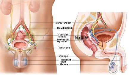 3 manivele (legendă)