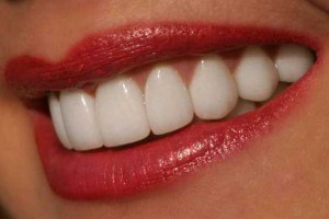 Cât de repede albi dintii la domiciliu - modalități eficiente