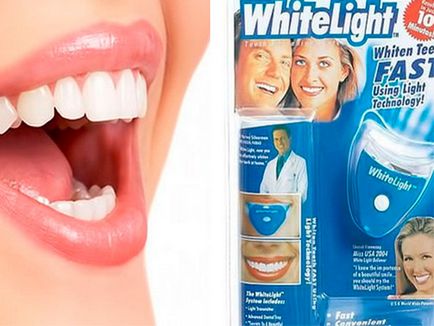 Cum de a albi dintii în condiții de acasă rețete