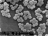 Cum este Staphylococcus aureus - măsuri preventive