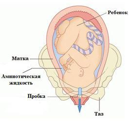 Cum să înțeleagă fotografiile stopper în trepte, înainte de livrare