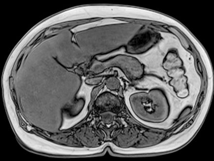 Cum să se pregătească pentru un RMN a abdomenului