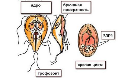 Giardia simptomelor copiilor și tratamentul giardiozei la un copil