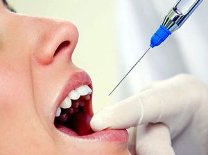 anestezie locală și generală în stomatologie în tratamentul dinților tipuri, preparate și metode