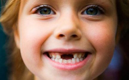 Dinții de lapte la copii de timp și pierderea de circuit