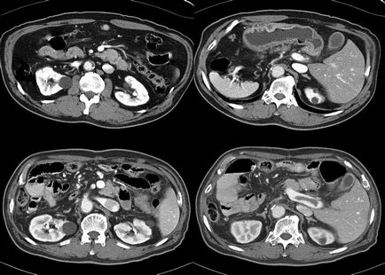 pregătirea mri abdominale pentru un studiu care arată prețul, recenzii, fotografii