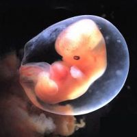 Nu a fost vizualizat embrionul