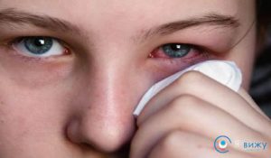 ochii umflati (din cauza alergii, pleoapelor umflate, foarte umflate din jurul ochilor și a ochilor) ce să facă