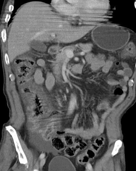 Caracteristici de pregătire a pacientului pentru a efectua imagistica prin rezonanta magnetica a organelor abdominale,