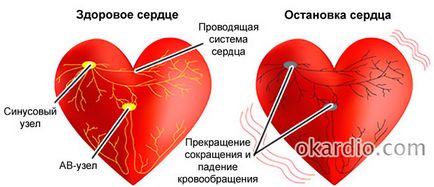 Insuficienta cardiaca cauze, simptome, de prim ajutor și prognoza