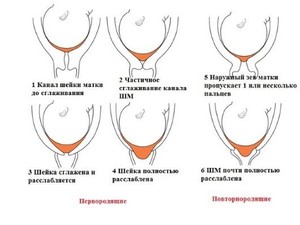 Deversarea de dop de mucus înainte de naștere, care trebuie să fie înțeleasă în timpul sarcinii, deoarece se îndepărtează și