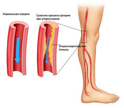 De ce picioarele doare și ce să facă cauze, simptome și tratament, Clinica Nara