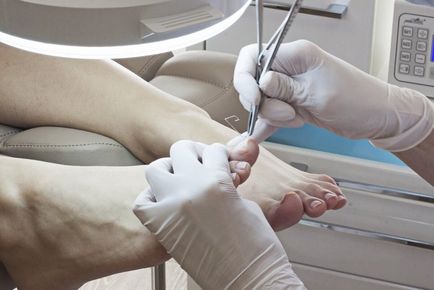 De ce cauzele si tratamentul unghiilor unghiile înnegrite de femei