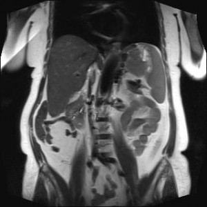 Pregătirile pentru RMN (tomografie) abdominale