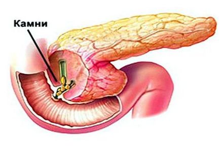 simptomele pancreas