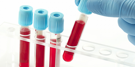 Creșterea ureei și creatininei în sânge determină rata de tratament
