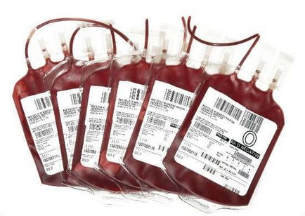 Cât de mult este un donator de sânge - bani și (sau) de viață salvată