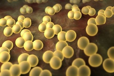 Staphylococcus aureus la sugari semnele leziunilor bacteriene
