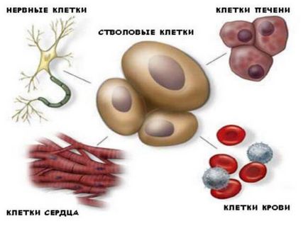 Utilizarea celulelor stem umane ale terapiei cu celule stem din sângele din cordonul ombilical