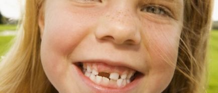 Conducerea Pierderea dintilor primare la copii programul atunci când încep să scadă, de câte ori se încadrează
