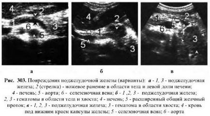 Examinarea cu ultrasunete a pancreasului