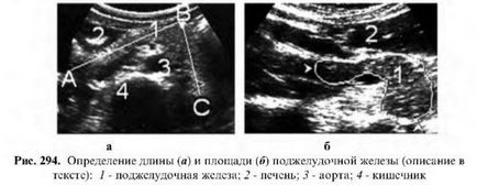 Examinarea cu ultrasunete a pancreasului