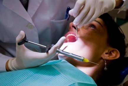 Tipuri de anestezie locală în stomatologie, metodele de