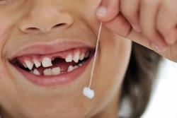 Pierderea dinților ordine de foioase și circuitul de sincronizare
