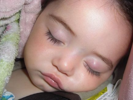 Orzul in fata simptomelor copilului, cauze si tratament