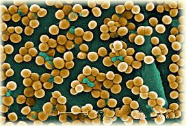 Simptome Staphylococcus aureus și tratament, raportate de infecție stafilococică