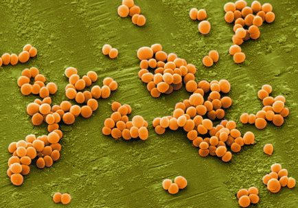 Staphylococcus aureus în simptome de copii, masura, efectele de S. aureus