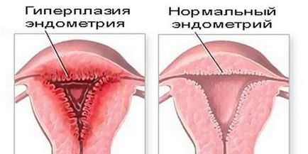 Care este faza de secreție endometriale