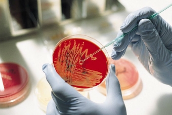 Cum de a trata Chlamydia la femei la antibiotice la domiciliu, lumânări, remedii populare