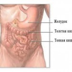 remedii populare de tratament gastro-intestinale