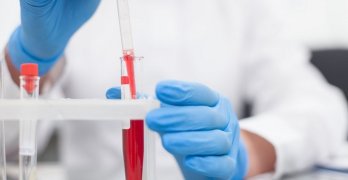 Hemoglobina cum să trateze Hemoglobina cum să trateze