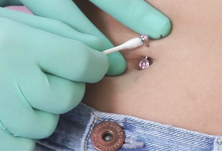 Cum de a vindeca un piercing buric