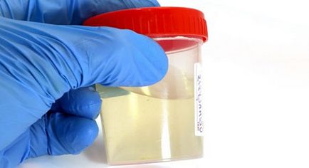 Cum de a crește celulele albe din sânge în urină