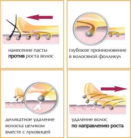 îndepărtarea părului de zahăr la domiciliu